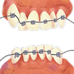 Dental Retainer emoji