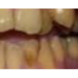 Bigteeth emoji
